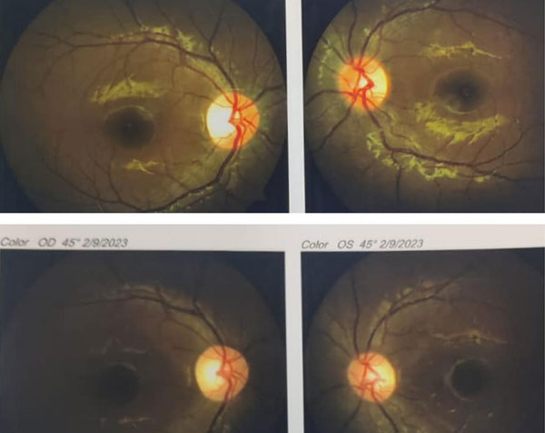 After Darkness Comes The Light